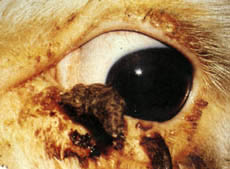 Cancer Eye